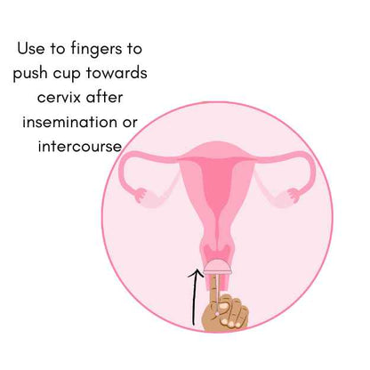 Using cup or conception cup inside out to push cupwards to towards the cervix
